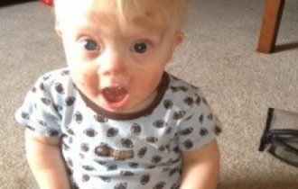 Beautiful Little Boy with Down's Syndrome