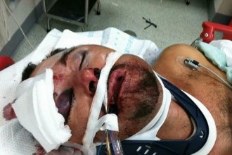 Brian Hatcher after police beating.  Photo provided by family to Greenville Online, www.greenvilleonline.com