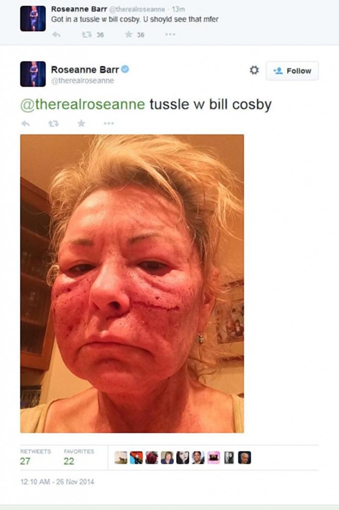 Roseanne Barr twitter http://assets.nydailynews.com/polopoly_fs/1.2024492.1416982457!/img/httpImage/image.jpg_gen/derivatives/article_970/roseanne27n-1-web.jpg?enlarged