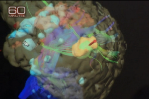 Duke University Study Could Prove That Polio Cures Cancer (VIDEO)