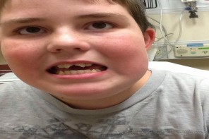 12-Year-Old Autistic Boy Left In Extreme Pain After Medicaid Refuses To Cover Dental Procedure