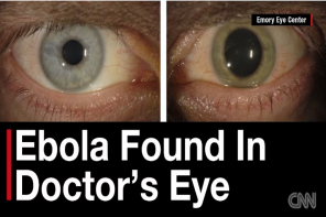 American Doctor Thought Cured Of Ebola Finds Virus In His Eye