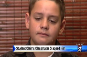 A Texas boy says his teacher told his classmates to slap him.