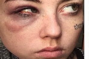 Lunatic Trump Supporter Beats The Hell Out Of Woman Who Painted ‘Micropenis’ Trump (IMAGE)