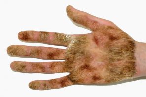 Forget Gun Violence And Zika: THIS Is What The GOP Says Is The Country’s ‘Public Health Crisis’